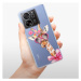 Odolné silikónové puzdro iSaprio - Lady Giraffe - Xiaomi 13T / 13T Pro