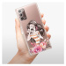 Odolné silikónové puzdro iSaprio - Charming - Samsung Galaxy Note 20