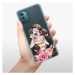 Odolné silikónové puzdro iSaprio - Charming - Nokia G11 / G21