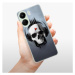 Odolné silikónové puzdro iSaprio - Skeleton M - Xiaomi Redmi 13C