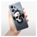 Odolné silikónové puzdro iSaprio - Skeleton M - Honor X7a