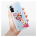 Odolné silikónové puzdro iSaprio - Lady Giraffe - Xiaomi Redmi Note 10 Pro