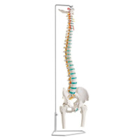 Erler Zimmer Flexibilná chrbtica človeka s hlavami stehennej kosti