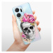 Odolné silikónové puzdro iSaprio - Pretty Skull - Honor X7a