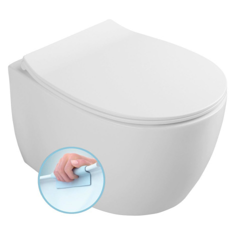 SENTIMENTI závesná WC misa, Rimless, 51x36 cm, biela (smartFixPlus) 10AR02010SV ISVEA