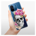 Odolné silikónové puzdro iSaprio - Pretty Skull - Xiaomi Redmi 12C