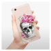 Odolné silikónové puzdro iSaprio - Pretty Skull - Xiaomi Redmi 4A