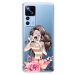 Odolné silikónové puzdro iSaprio - Charming - Xiaomi 12T / 12T Pro