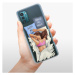 Odolné silikónové puzdro iSaprio - Dance and Sleep - Nokia G11 / G21