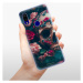 Odolné silikónové puzdro iSaprio - Skull in Roses - Xiaomi Redmi 7