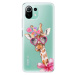 Odolné silikónové puzdro iSaprio - Lady Giraffe - Xiaomi Mi 11 Lite